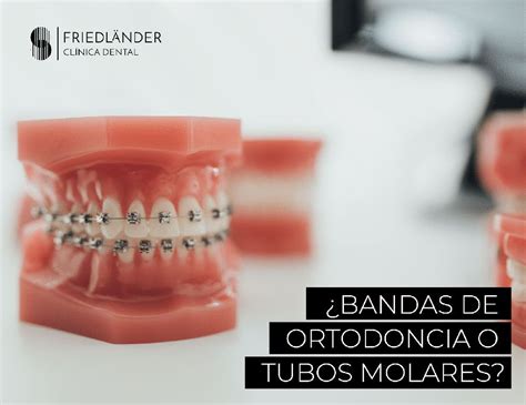 bandas de ortodoncia uso